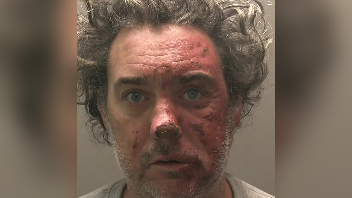 domestic-violence-england-case